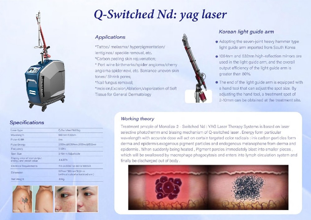 Professional Vertical Nd yag Laser System